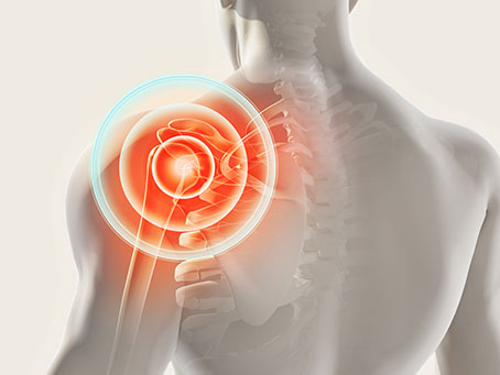 Expert Orthopaedic Surgeon for Shoulder & Knee Injuries